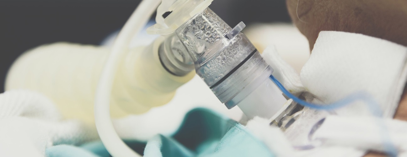 LifeSaving Tracheostomy Care A Guide to Humidification, Suctioning